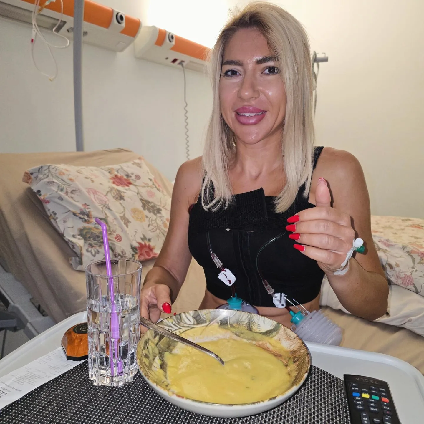 Jovana posle operacije Jovana posle operacije