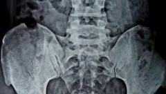 NATPRIRODNE SPOSOBNOST: Ruskinja Nataša Demkina tvrdi da je dama sa rendgenskim očima!