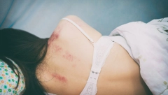 HOROR STATISTIKA Zlostavljana svaka peta devojčica u Srbiji