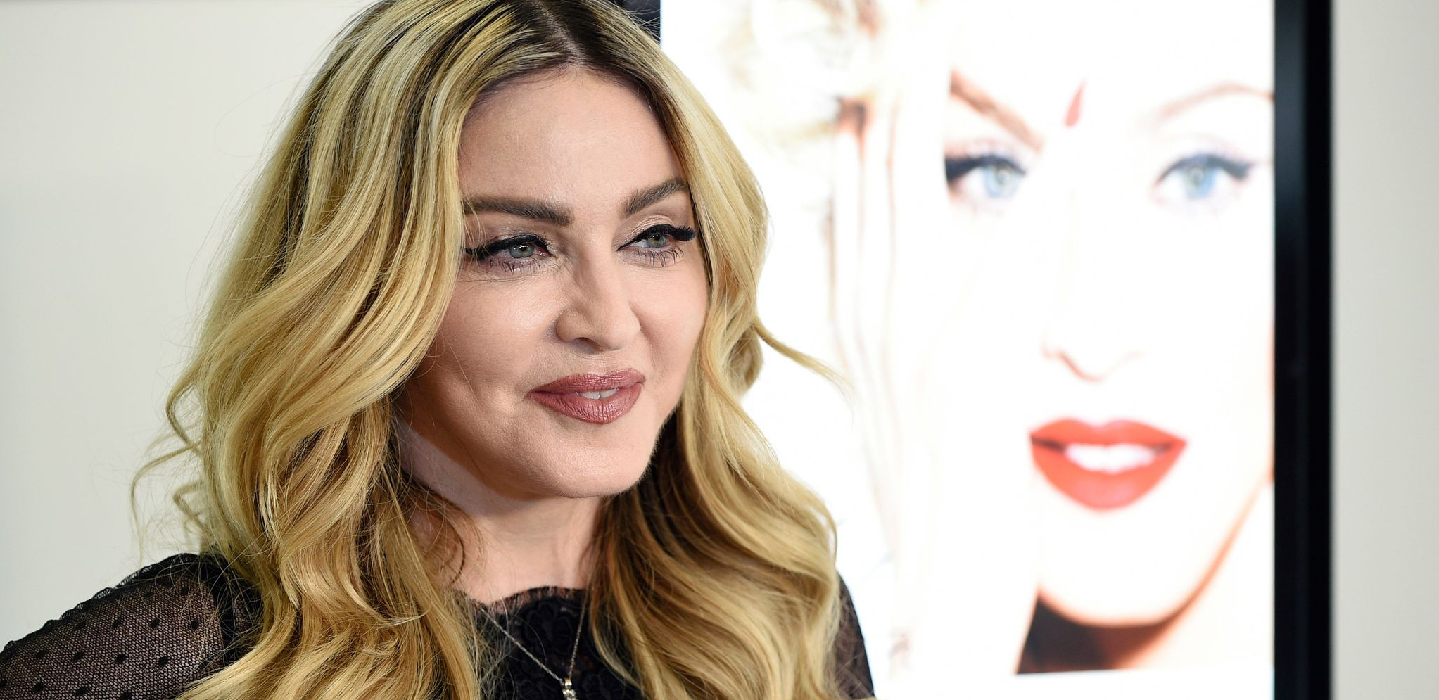 MADONA POKAZALA ZASTRAŠUJUĆE PODLIVE! Pevačica uplašila sve: Ko te je povredio? (FOTO)