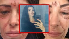 ONA ĆE DA DOBIJE 3 GODINE ZATVORA, A JA SAM UNAKAŽENA ZA CEO ŽIVOT! Žrtva nadrilekarke sa Senjaka o optužnici protiv Olgice