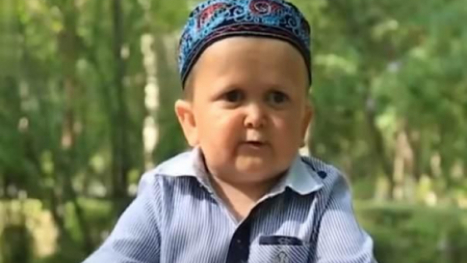 "MINI KABIB"  Čovek zarobljen u telu deteta boluje od retkog poremećaja! (VIDEO)