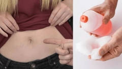 ZVUČI ČUDNO ALI OVAJ NARODNI LEK POMAŽE Stavite ovu stvar u pupak i začas se rešite prehlade i bolova
