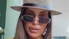 DALILA JE ZBOG USANA UMALO UMRLA, A SAD JE SKINULA KONCE I POKAZALA KAKO IZGLEDA Šok izdanje rijaliti učesnice! (VIDEO)