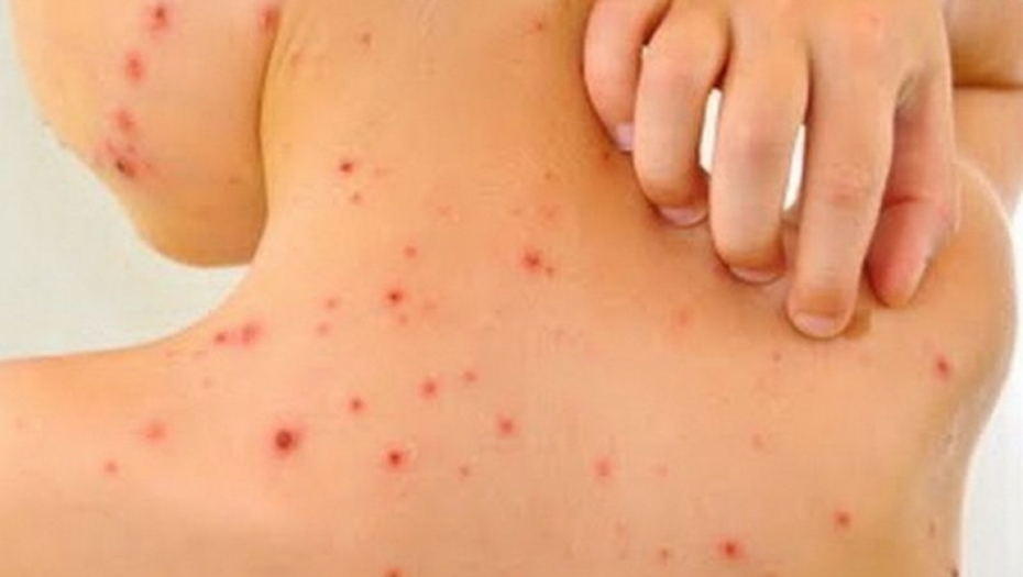 OVO JE OZBILJNO! AMERIKANCI DOŠLI DO NOVIH DOKAZA O DELTA SOJU: Širi se kao varičele, jedan će zaraziti 8, 9 osoba