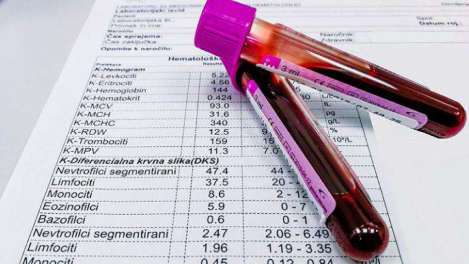 PRIRODNA TRANSFUZIJA Ova 3 vitamina bukvalno hrane krv