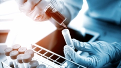 SVETSKI DAN BORBE PROTIV HIV-A Od početka godine u Srbiji bolest otkrivena kod 152 osobe