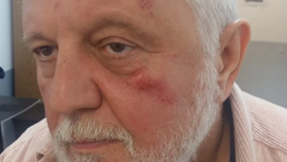 TUKAO ME JE ZBOG DARE IZ JASENOVCA, BJELOGRLIĆ JE KORUPCIONAŠ Jezivi detalji brutalnog prebijanja Gage Antonijevića