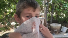 MALI MIHAJLO NOVA ŽRTVA TERORA NAD SRBIMA NA KOSOVU Albanski krvnici tukli dete bez milosti!