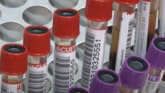 EVO ŠTA NE SMETE DA RADITE POSLE DOBROVOLJNOG DAVANJA KRVI:  Neka pravila moraju da se ispoštuju, ovo je detaljan spisak