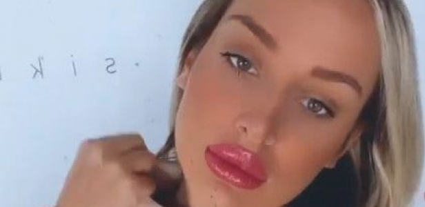 POVREDILA SE LUNA ĐOGANI! Hitno je morala da se javi lekaru, a nakon toga joj je data ova terapija!