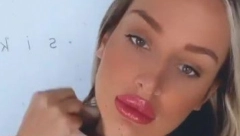 POVREDILA SE LUNA ĐOGANI! Hitno je morala da se javi lekaru, a nakon toga joj je data ova terapija!