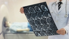 AKO IH PRIMETITE NA VREME MOŽETE SPASITI ŽIVOT Doktor otkrio simptome kancera koji se javljaju rano ujutro