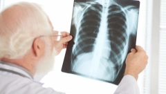 SMANJITE RIZIK OD NAJTEŽE BOLESTI Ove namirnice najbolje čiste pluća od nikotina