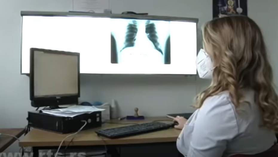 AKO STE PRELEŽALI KORONU, NAJGORE TEK DOLAZI Infekcije je ostavila tragove po celom organizmu, evo koje tegobe su najopasnije