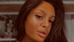 NINU ĐOGANI OPTUŽILI DA IZBELJUJE KOŽU Lunina sestra trpi stravične napade!