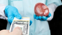 OVAKO SU ORGANIZOVANI "DILERI" ORGANA Za jedan bubreg se može dobiti i do 100.000 evra