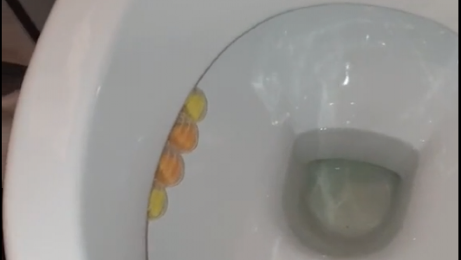 BACI UPALJENU ŠIBICU U WC ŠOLJU To će vam pomoći u borbi protiv jednog problema