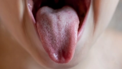 BAKTERIJE, KVRŽICE I BELE MRLJE: Uzmite ogledalo i otkrijte šta izgled jezika govori o vašem zdravlju