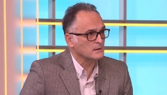 DA LI SU TAMNI PODOČNJACI ZNAK OBOLENJA BUBREGA? Dr Radović otkriva da u Srbiji od ove bolesti umre 2000 ljudi godišnje