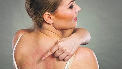 OVE NAMIRNICE IZAZIVAJU ALERGIJU Bićete u čudu kada budete videli vaš omiljen slatkiš na listi