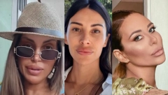 KAD ESTETSKE INTERVENCIJE KRENU NAOPAKO Htele su zanosne usne, a na kraju su platile papreno da bi ih smanjile!