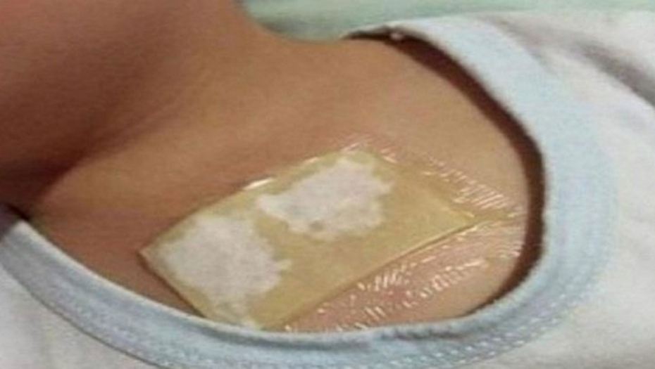 MEDENI OBLOG JE SPAS Za samo jednu noć jak kašalj će prestati, a od sekreta iz pluća i bronhija neće ostati ni trag