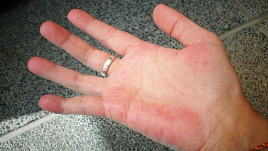 IMAJU GA SAMO POSEBNI LJUDI Proverite da li je na vašem dlanu ucrtano ovo slovo