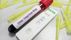 BRITANCI U STRAHU OD NOVE EPIDEMIJE Žena obolela od smrtonosnog virus nalik eboli - ovo su simptomi!