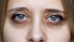 ZABORAVITE NA KOREKTOR Evo kako da uz pomoć CRVENOG KARMINA podočnjake sakrijete za tren