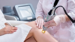 SKUSTVA ŽENA SA LASERSKOM EPILACIJOM: Pripremite kožu i zaštitite je od fleka i opekotina, evo gde nikako ne smete da skidate dlačice