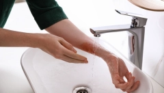 Imate opekotinu? Ovu namirnicu sigurno imate u kuhinji, a bolja je od bilo kog melema