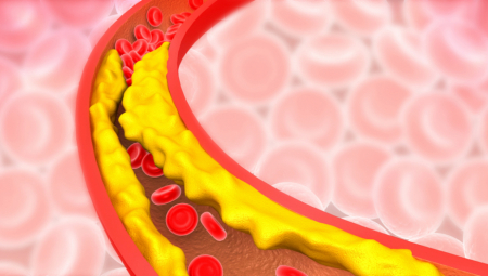 POMAŽE SRCU I TELU DA LAKŠE RADE Samo kašika ovog soka dnevno očisti arterije do zdravog tkiva