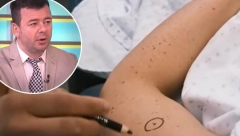 DERMATOLOG OTKRIO KOJI SU NAJOPASNIJI MLADEŽI: Evo koje ne treba da dirate i koje hitno treba da uklonite!