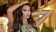 SORAJA SVA U MODRICAMA Šok objava starlete, fotografije se šire mrežama, lice izobličeno (FOTO)
