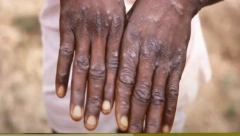 "BATUT" OBJAVIO UPUTSTVO O MAJMUNSKIM BOGINJAMA U njemu se ističe da one nikada nisu zabeležene kod nas