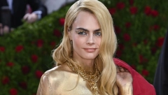 POZNATA MANEKENKA PATI OD OPAKE BOLESTI Na Met Gali telo je ofarbala u zlatno, ali pečate na koži ostavila je vidljivim