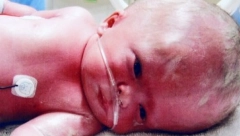 DEČAK JE ROĐEN SA DVA ODSTO MOZGA Lekari su rekli da nema nikakvu šansu, danas ima devet godina i medicinsko je čudo (FOTO)