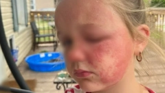 DEVOJČICA (6) UMALO UMRLA ZBOG OTROVNE BILJKE: Raste u srpskim dvorištima, izgleda kao bezopasan korov, a ustvari je smrtonosna