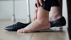AKO PRIMETITE OVE PROMENE, ODMAH SE JAVITE LEKARU: Ukazuje na krvni ugrušak koji se može naći blizu srca, mozga ili pluća