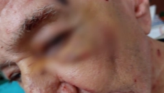 DRAMA U GERONTOLOŠKOM CENTRU U OBRENOVCU Pretukli joj oca u domu za stare?