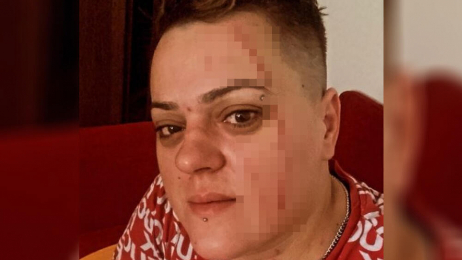 PRETUČENA BIVŠA UČESNICA RIJALITIJA?! Sanju davila i udarala sestra nestale Marijane iz Velikog brata, isplivali svi skandalozni detalji