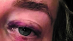 DETALJI NASILJA NAD DEVOJKOM NA DIVČIBARAMA Lomio joj rebra, pa rekao da je ku*va i smeće!