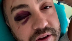 SVE JE SMRSKANO, MORA OPERACIJA Teško povređen crnogorski komičar koji je oduševio Novaka Đokovića: Pukla mu čeona kost, otvaraju ga (VIDEO)