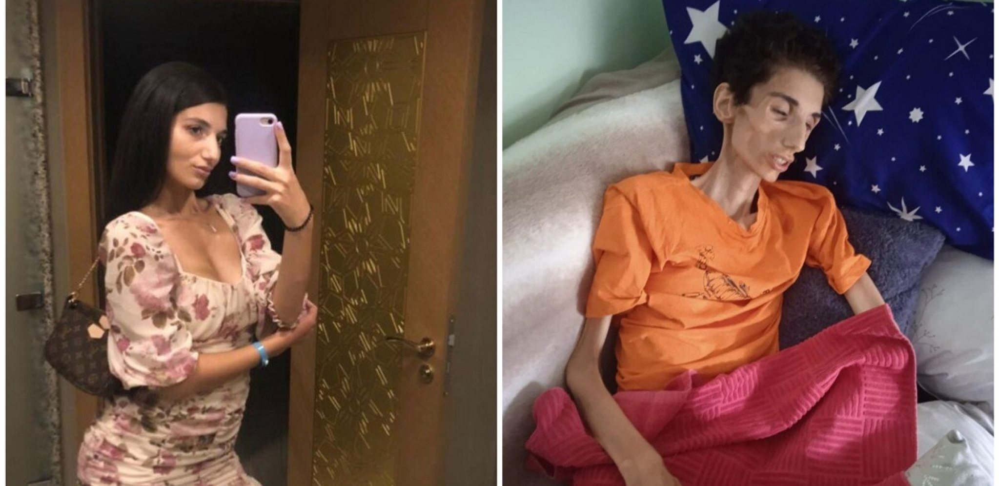 "BOJIM SE, MOŽDA SE NIKAD NEĆE VRATITI": Majka u suzama se bori za ćerku Sanelu kojoj je hitno potrebna naša pomoć
