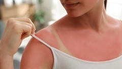 IZGORELA SAM NA SUNCU, SVEKRVIN TRIK ME SPASIO ZA POLA SATA Fora je u jednom proizvodu koji svi imamo kod kuće, a nije kiselo mleko