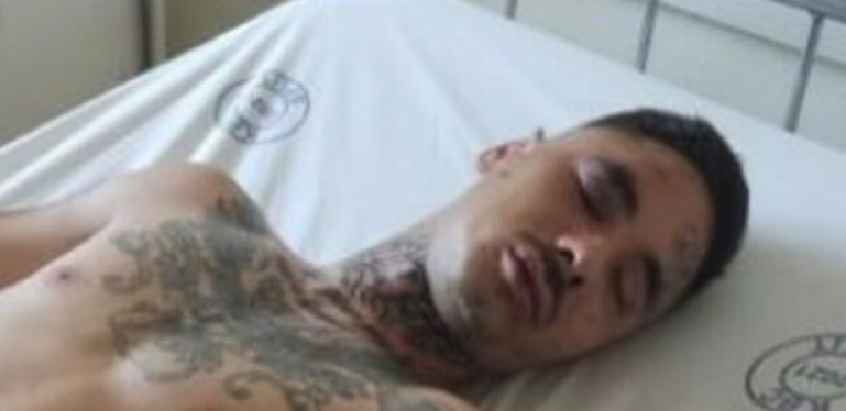 IZBODEN BIVŠI ZADRUGAR! Otkriveni svi detalji nakon što je hitno prebačen u bolnicu sa jezivim povredama, ničega se ne seća