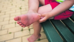 OPREZ! Susret s morskim paukom može biti veoma bolan: Pazite gde stajete