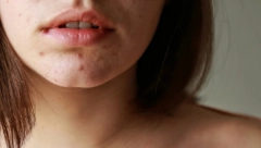 NIKAKO NE IGNORIŠITE BUBULJICE NA BRADI Ukazuju na ozbiljan zdravstveni problem, ovo je razlog njihovog pojavljivanja