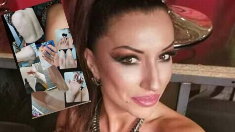 PRETUČENA PEVAČICA TRAŽI POLICIJSKU ZAŠTITU Njen bivši partner se sam predao, a evo koliko godina može da dobije robije